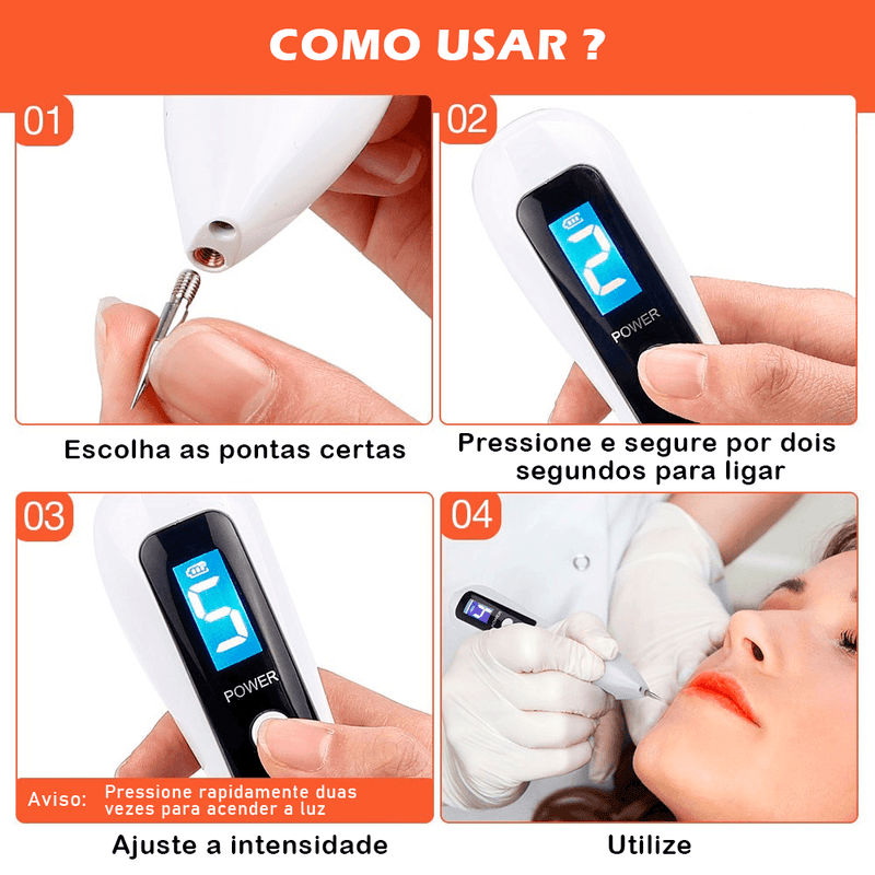 CANETA LASER (REMOVEDORA DE MANCHAS E VERRUGAS) - Loja Tudo Aqui