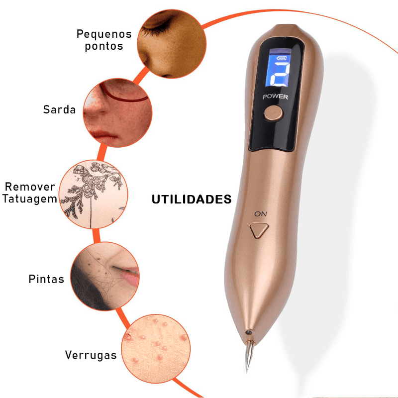 CANETA LASER (REMOVEDORA DE MANCHAS E VERRUGAS) - Loja Tudo Aqui